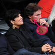 Bruce Jenner hat eine deutliche Narbe auf der Wange Bruce Jenner hat eine deutliche Narbe auf der Wange