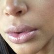 Kim Kardashian gibt der Schwangerschaft die Schuld an der dicken Lippe