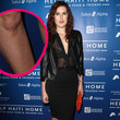 Rumer Willis hat ein geschundenes Knie
