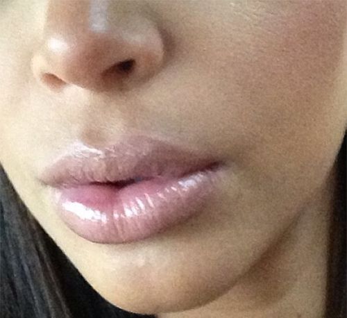 Kim Kardashian gibt der Schwangerschaft die Schuld an der dicken Lippe