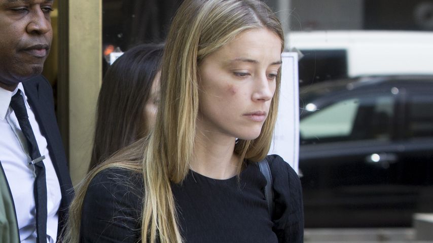 Amber Heard mit vermeintlichen Verletzungen bei einem Gerichtstermin