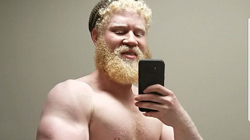 Dieser Fitness-Freak will stärkster Albino der Welt werden