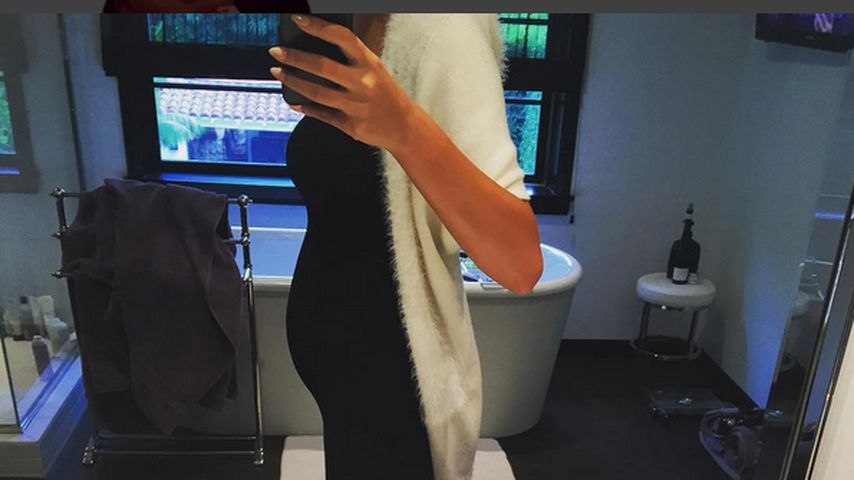 Chrissy Teigen
