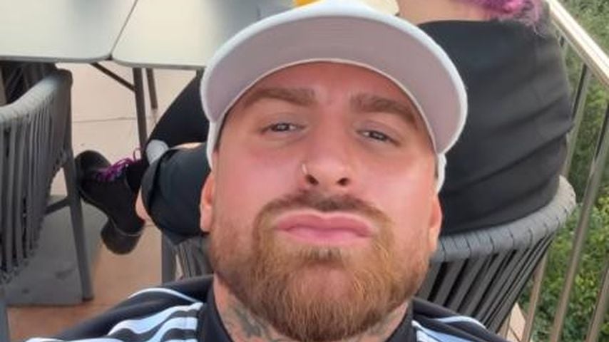 Er vermisst seine Jawline: Gigi Birofio lässt nachhelfen