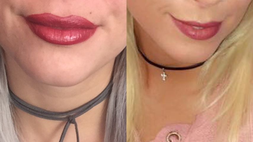 Jennifer Frankhausers Lippe im Nacher-Vorher-Vergleich