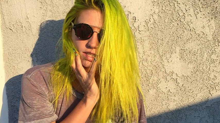 Kesha