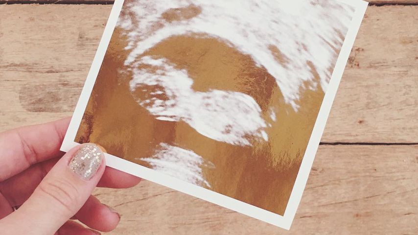 Ultraschallbild von Lauren Conrad, Designerin
