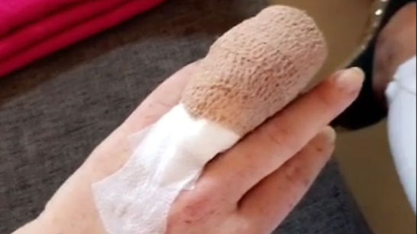 Lindsay Lohans Finger nach einer Operation