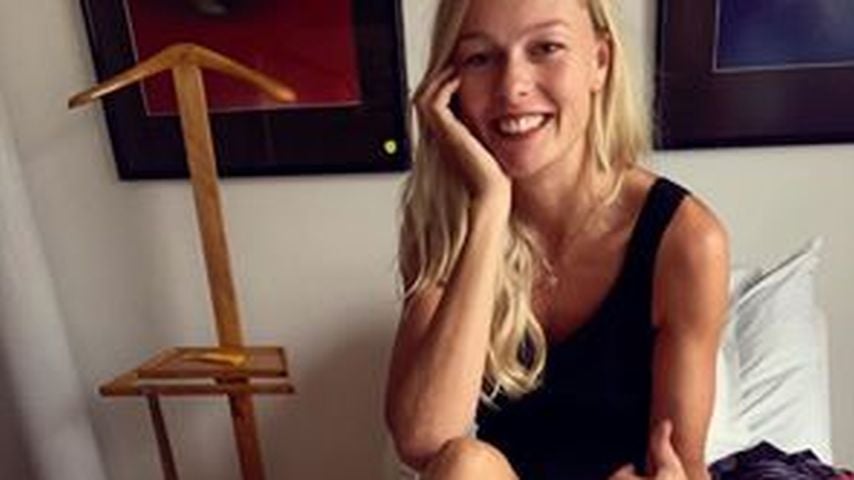 Miriam Höller zeigt ihre Verletzung