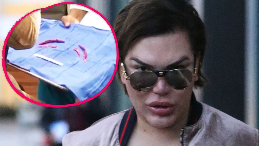 Real-Life-Ken Rodrigo: Hier zeigt er seine entfernten Rippen