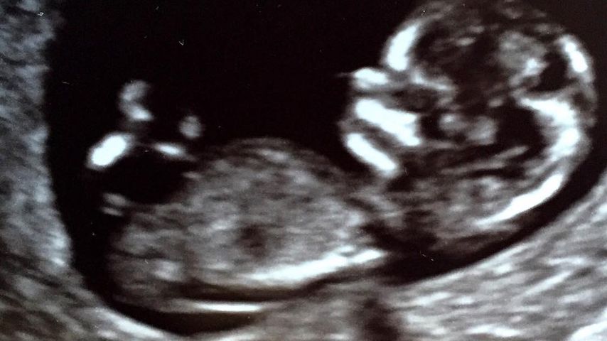 Ultraschall Bild von Katherine Heigls Sohn