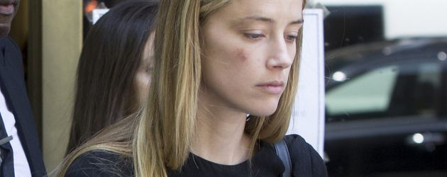 Amber Heard mit vermeintlichen Verletzungen bei einem Gerichtstermin Amber Heard mit vermeintlichen Verletzungen bei einem Gerichtstermin