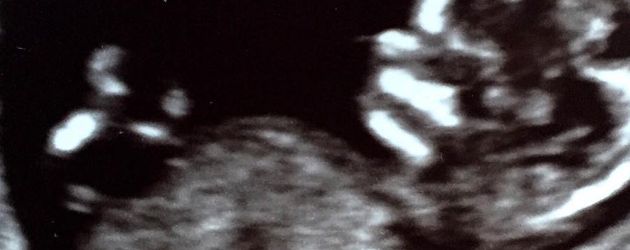 Ultraschall Bild von Katherine Heigls Sohn Ultraschall Bild von Katherine Heigls Sohn